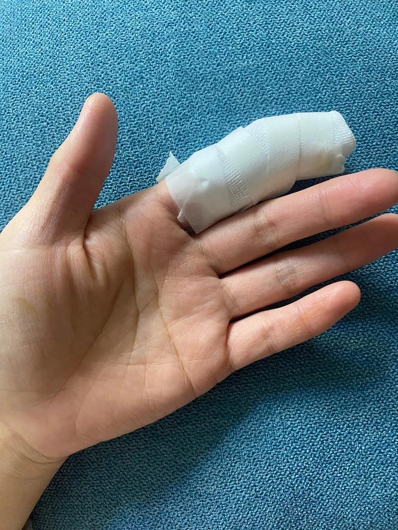 竹子怎么养叶子不黄？竹子怎样养才能不黄叶？-第4张图片-优品飞百科