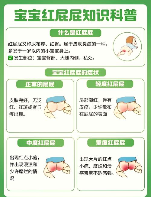 红稚儿的繁殖方法,红稚儿开花要剪掉吗?-第5张图片-优品飞百科 红稚儿的繁殖方法,红稚儿开花要剪掉吗?-第5张图片-优品飞百科