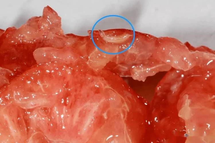 樱桃里面有虫能吃吗，樱桃里有虫子吃了对身体有害吗-第1张图片-优品飞百科