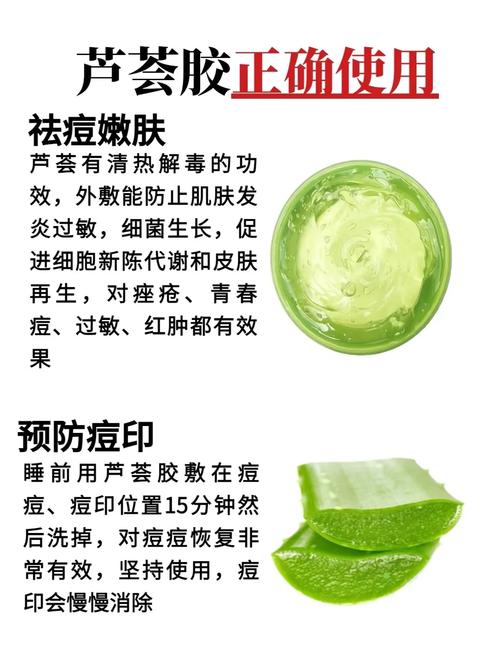 芦荟胶可以去疤吗，芦荟胶能祛痘吗，芦荟胶能去疤吗?-第2张图片-优品飞百科