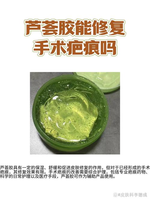 芦荟胶可以去疤吗，芦荟胶能祛痘吗，芦荟胶能去疤吗?-第4张图片-优品飞百科