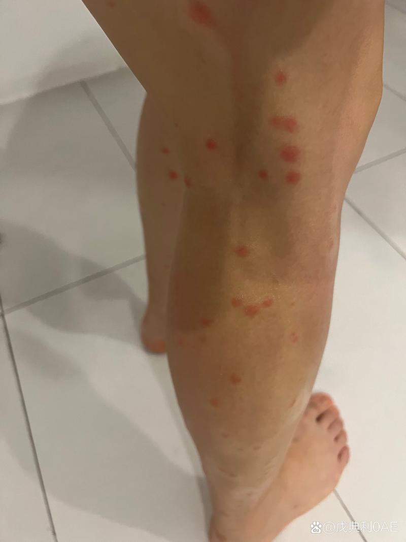 蓟马是什么，对人体有害吗，蓟马是什么?？-第3张图片-优品飞百科