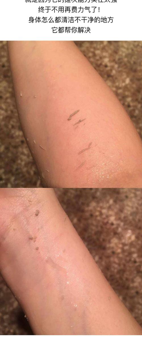 包含这种“脏东西”的词条-第7张图片-优品飞百科